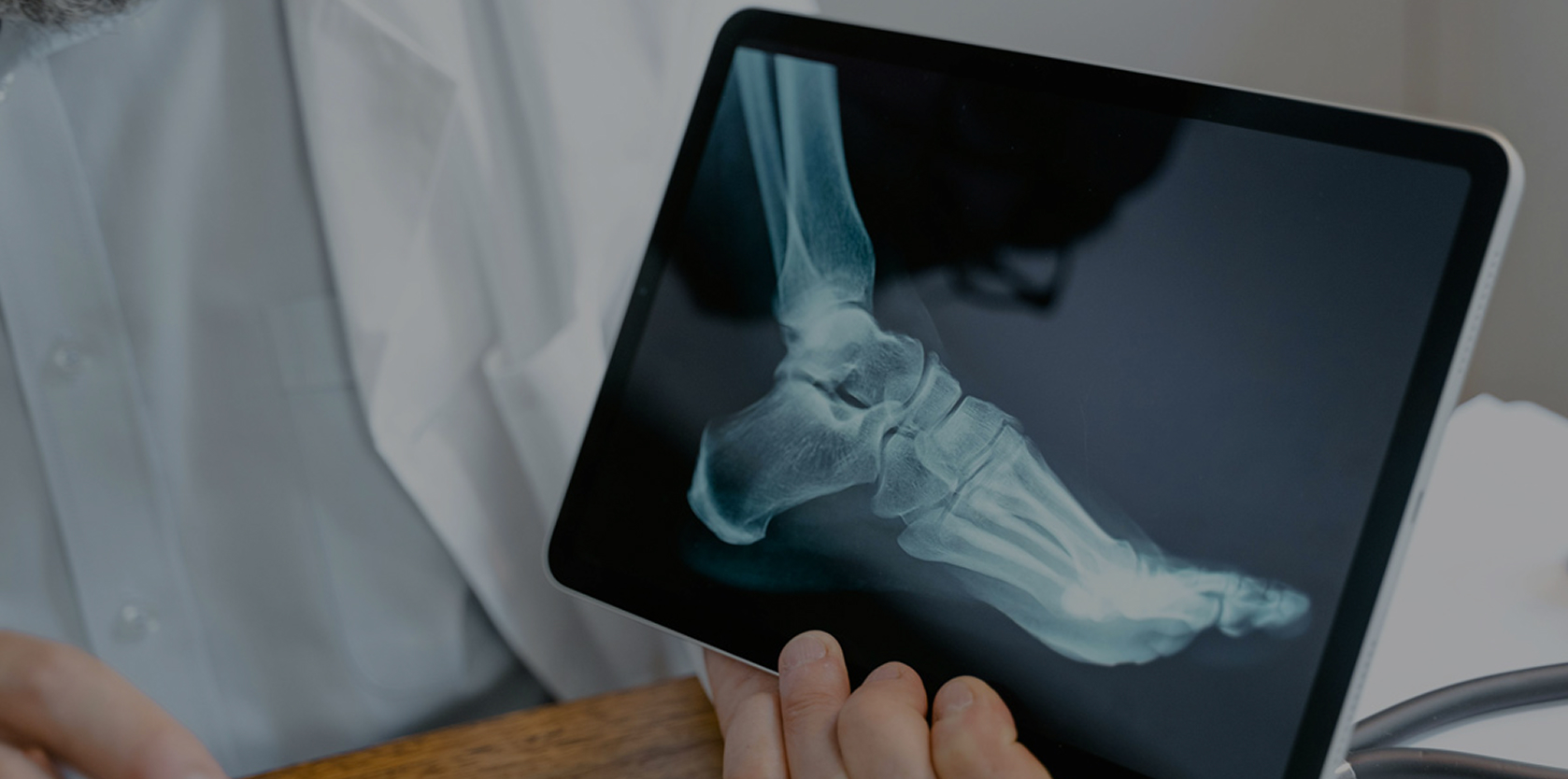 Foot and Ankle Arthroscopy